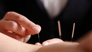 Acupuncture Neck